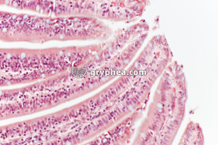 Villosités en Cl Iléon x100 - gryphea.org